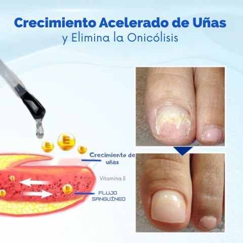 Biancat® OnyxoGuard - Suero para el Crecimiento y Reparación de Uñas