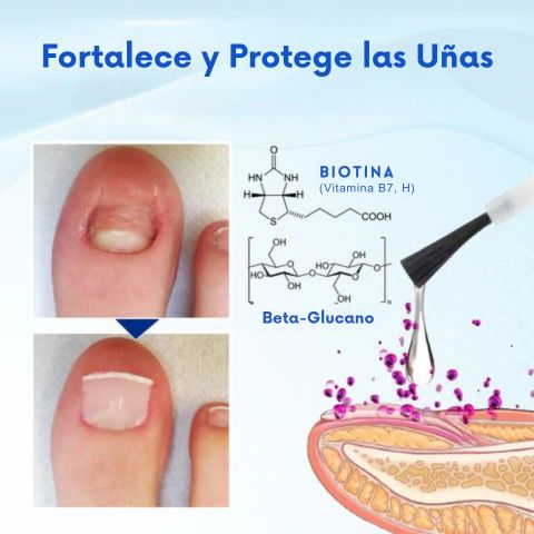 Biancat® OnyxoGuard - Suero para el Crecimiento y Reparación de Uñas